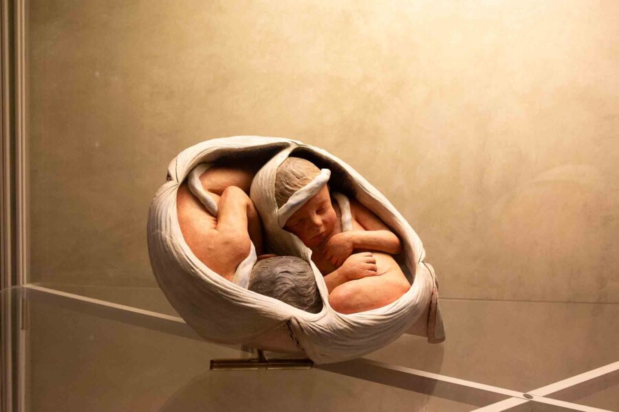 Palazzo Poggi Fetus